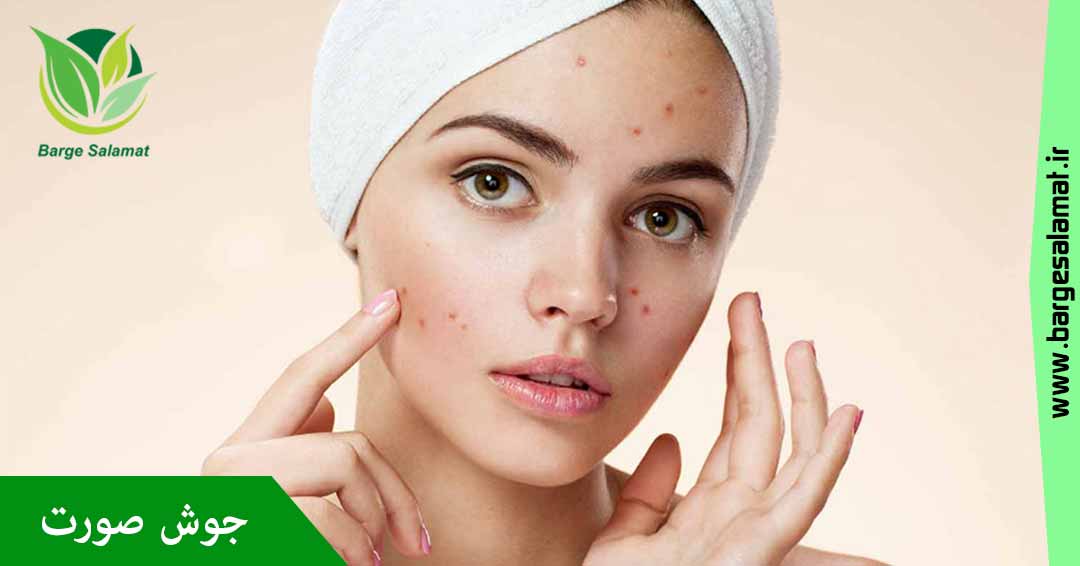 جوش صورت جوش صورت