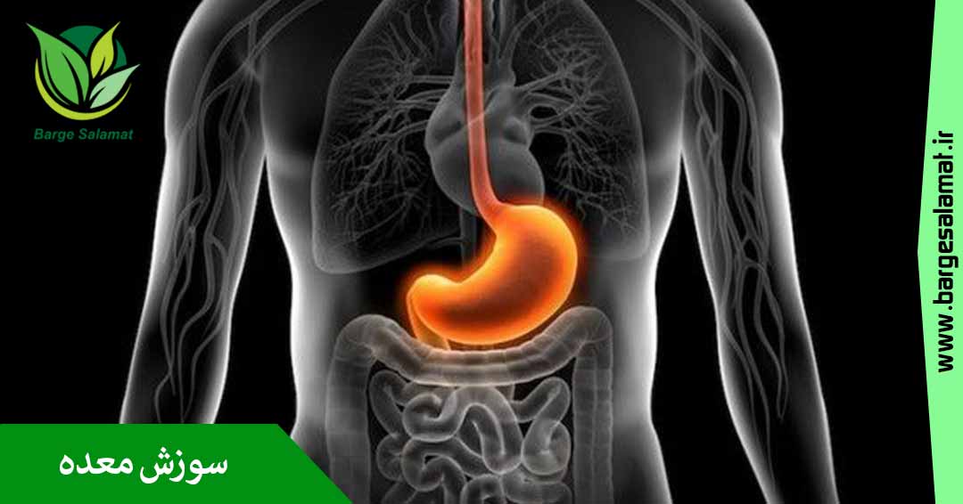 دلایل و درمان سوزش معده دلایل و درمان سوزش معده